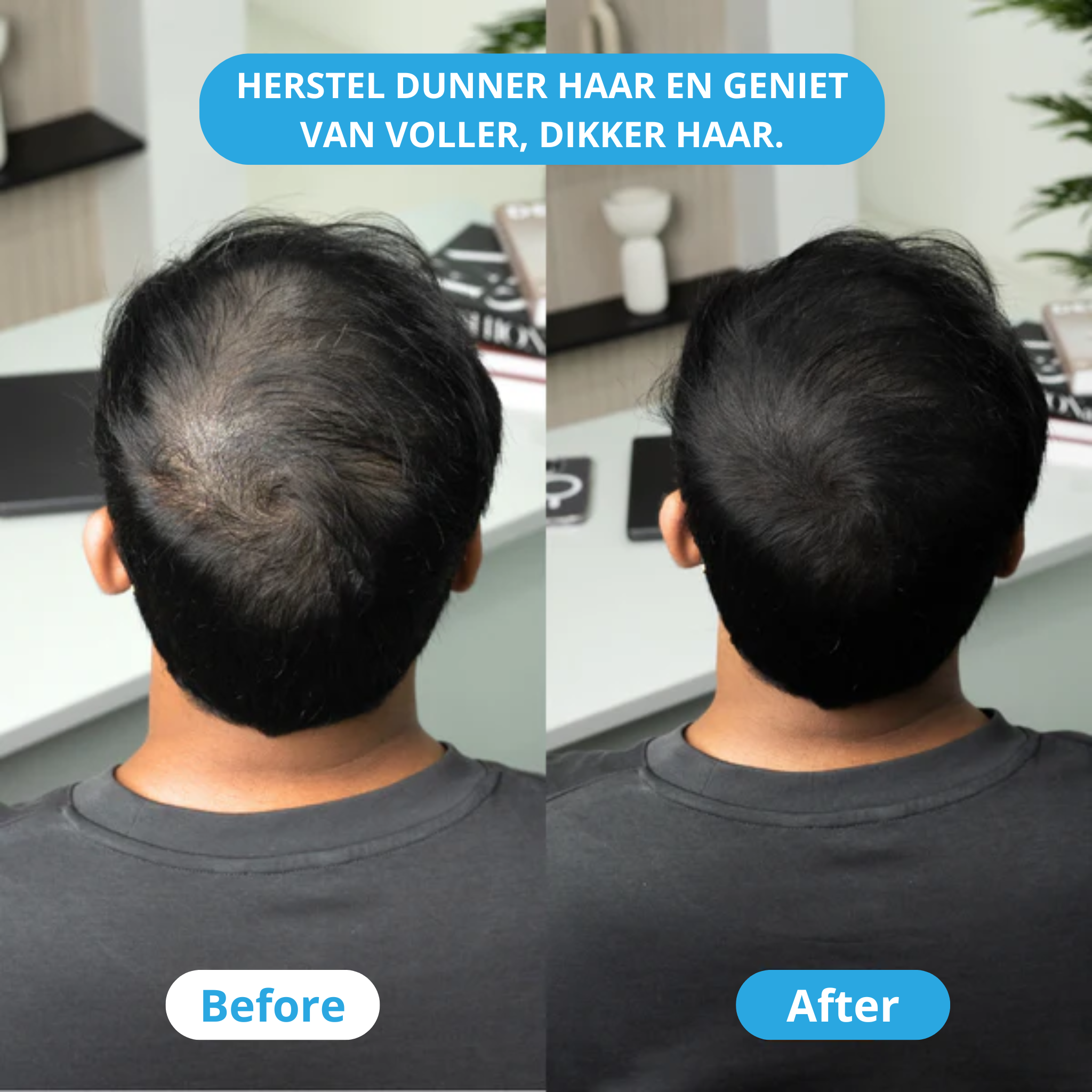 ThickUP Haarvuller Poeder