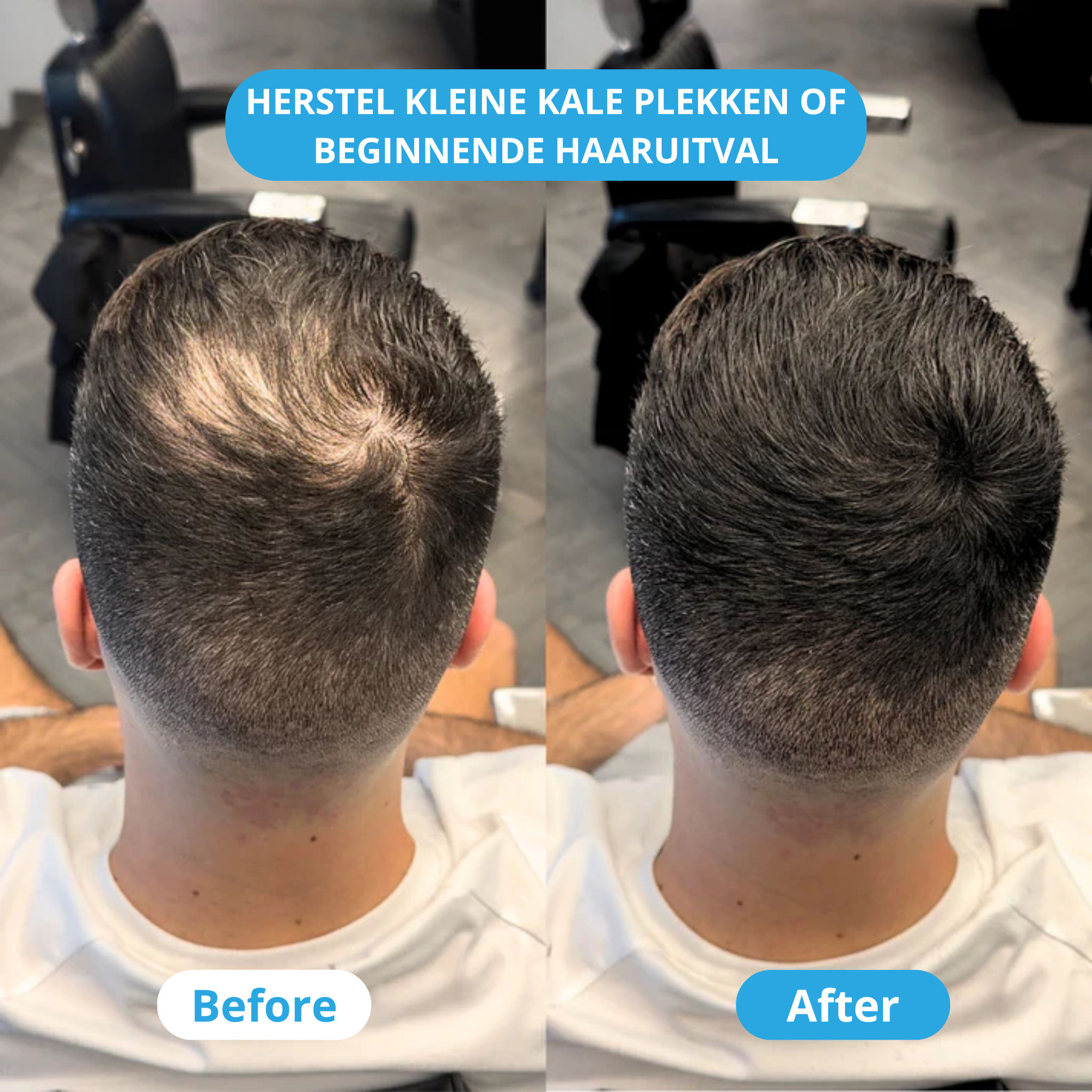 ThickUP Haarvuller Poeder