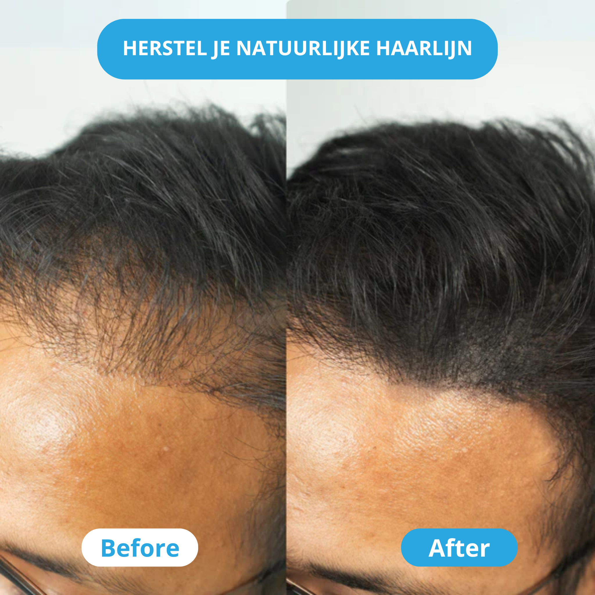 ThickUP Haarvuller Poeder