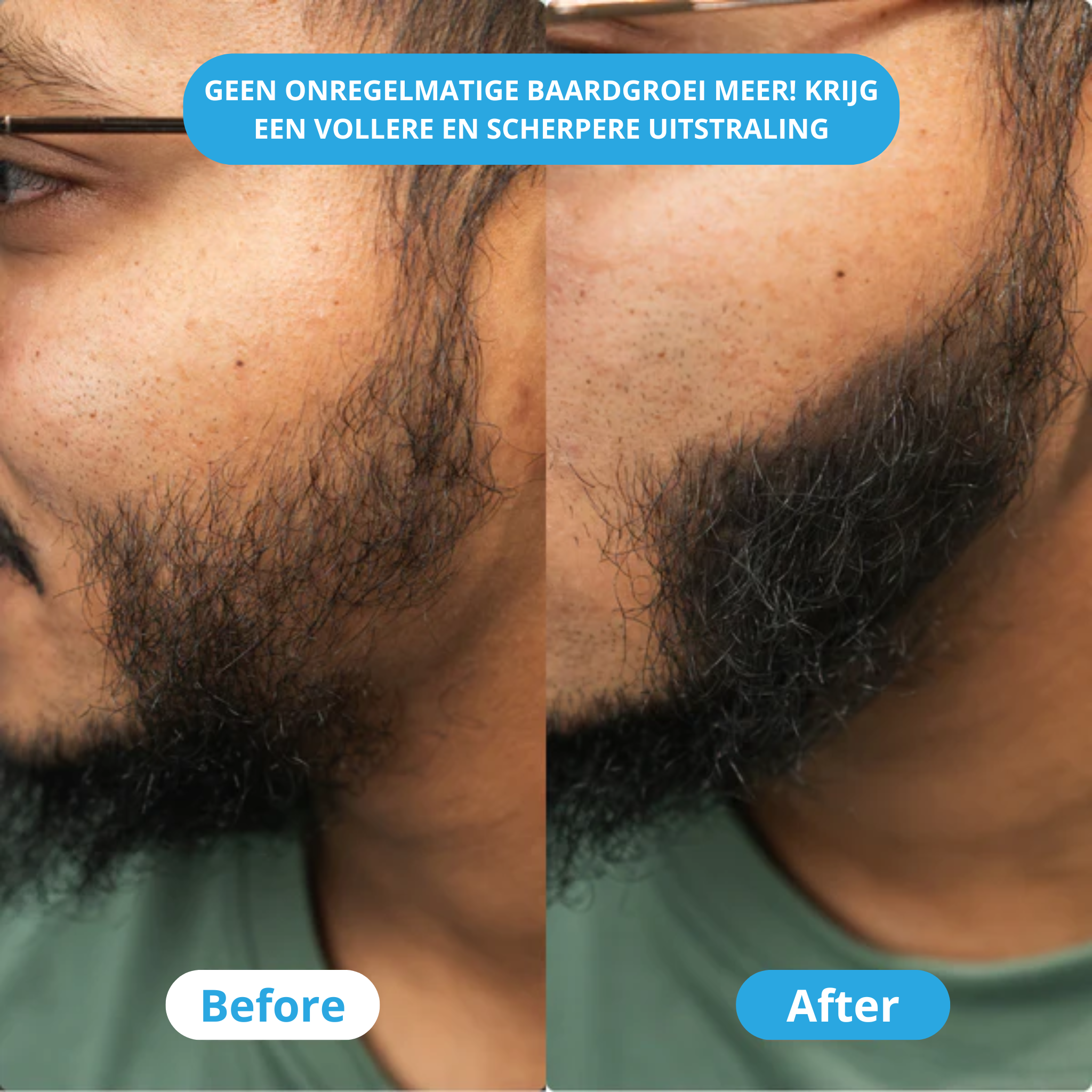 ThickUP Haarvuller Poeder